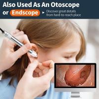 How The Microscope Changed The World ?